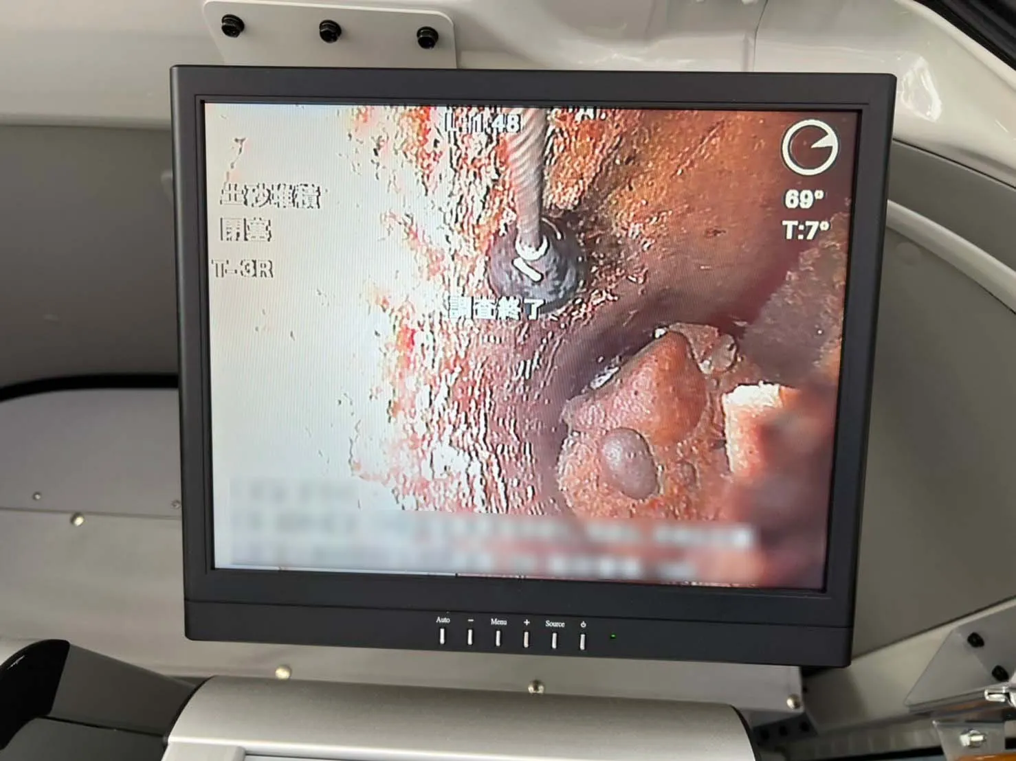 不明管の内部状況確認